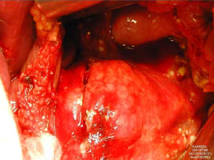 КАФЕДРА ХИРУРГИИ МОСКОВСКОГО ФАКУЛЬТЕТА 
