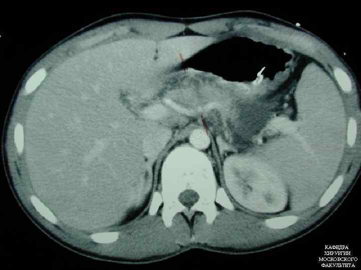 КАФЕДРА ХИРУРГИИ МОСКОВСКОГО ФАКУЛЬТЕТА 
