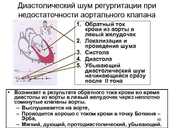 Регургитация аортального клапана