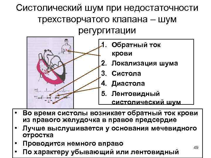 Симптомы регургитации митрального клапана