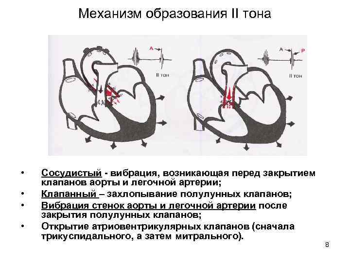 Сердечный механизм. Механизм образования 2 тона сердца. Механизм образования 1 и 2 тонов сердца. Механизм образования 2 Иона сердца. Механизм формирования 1 тона сердца.