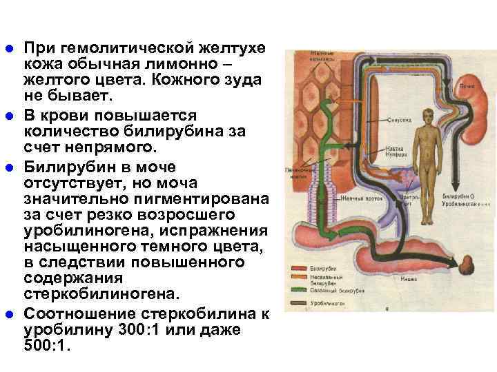 l l При гемолитической желтухе кожа обычная лимонно – желтого цвета. Кожного зуда не