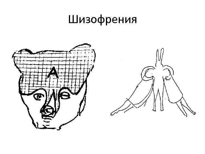 Шизофрения 