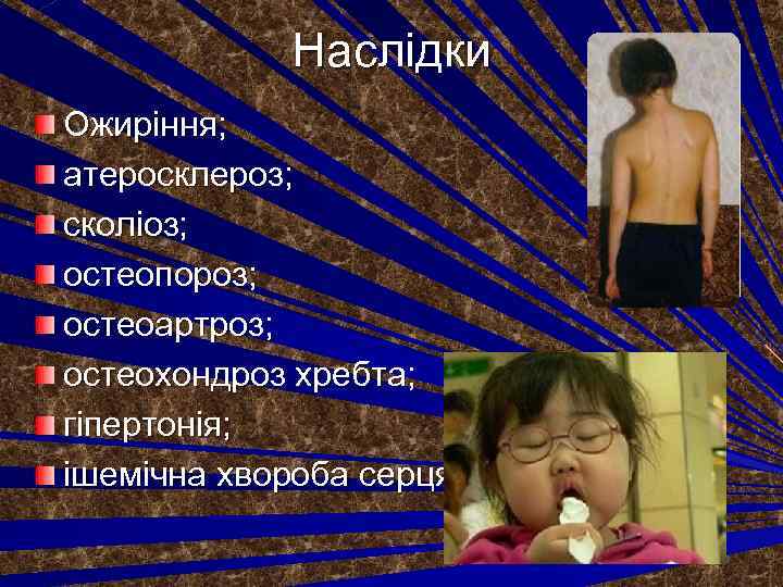Наслідки Ожиріння; атеросклероз; сколіоз; остеопороз; остеоартроз; остеохондроз хребта; гіпертонія; ішемічна хвороба серця 