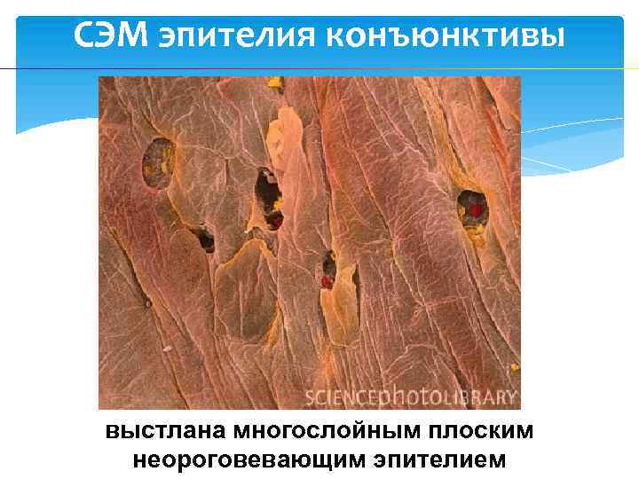 СЭМ эпителия конъюнктивы выстлана многослойным плоским неороговевающим эпителием 