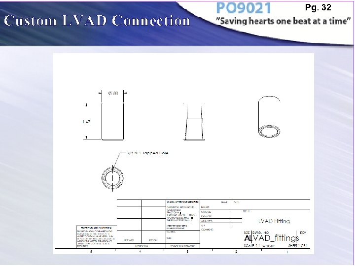 Custom LVAD Connection Pg. 32 