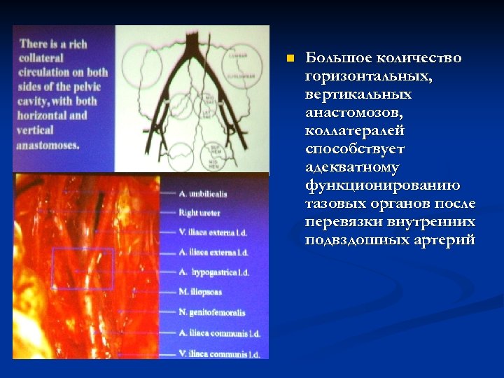n Большое количество горизонтальных, вертикальных анастомозов, коллатералей способствует адекватному функционированию тазовых органов после перевязки