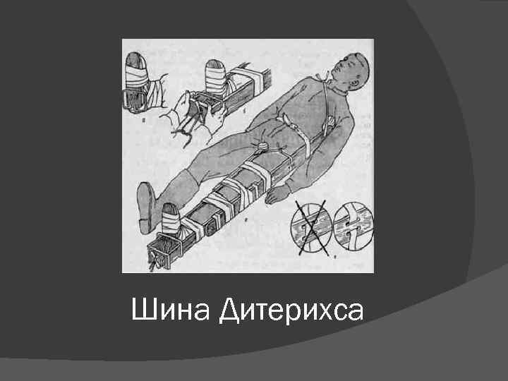 Шина Дитерихса 