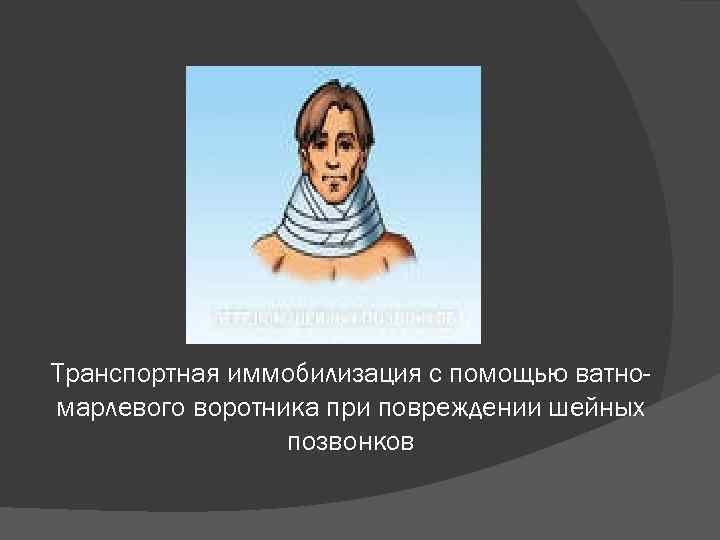 Транспортная иммобилизация с помощью ватномарлевого воротника при повреждении шейных позвонков 