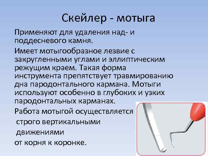 Скейлер - мотыга Применяют для удаления над- и поддесневого камня. Имеет мотыгообразное лезвие с