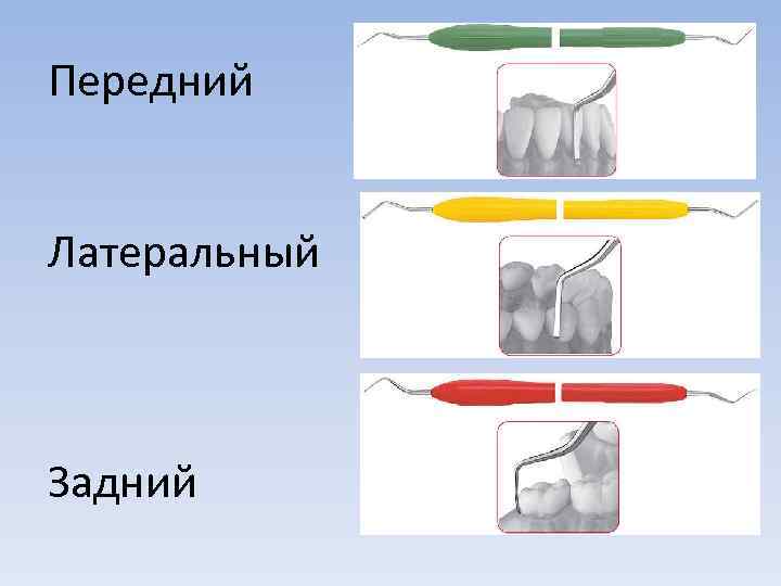 Передний Латеральный Задний 