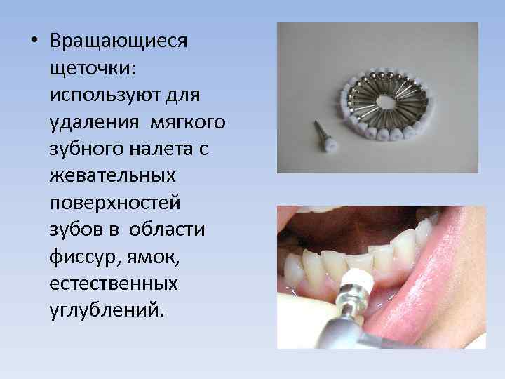 Воски стоматологические презентация