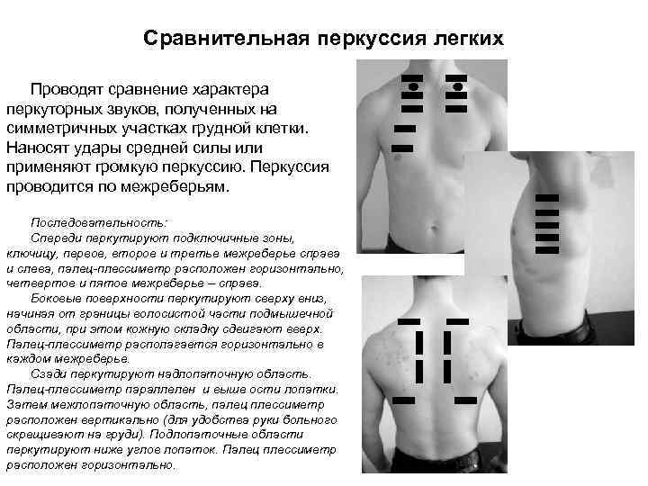 Схема сравнительной перкуссии легких