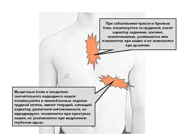 При заболевании трахеи и бронхов боль локализуется за грудиной, носит характер саднения, жжения, неинтенсивная,