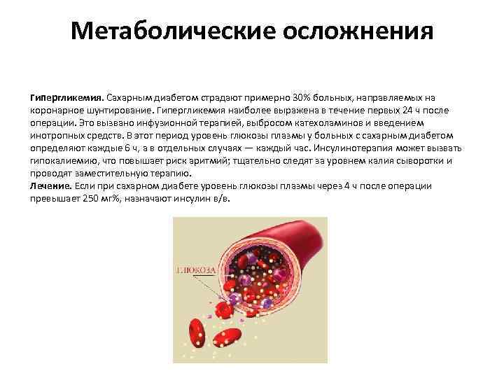 Операции при диабете. Операции при сахарном диабете. Метаболические осложнения сахарного диабета. Гипергликемия после операции. Осложнения операций при сахарном диабете.