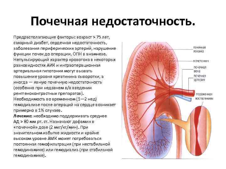 Почка при почечной недостаточности. Сердечная и почечная недостаточность. Недостаточность почек. Нарушение функции почек.