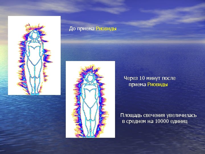 До приема Риовиды Через 10 минут после приема Риовиды Площадь свечения увеличилась в среднем
