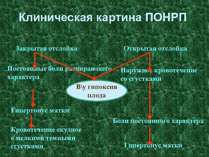 Клиническая картина ПОНРП Закрытая отслойка Открытая отслойка Постоянные боли распирающего Наружное кровотечение характера со