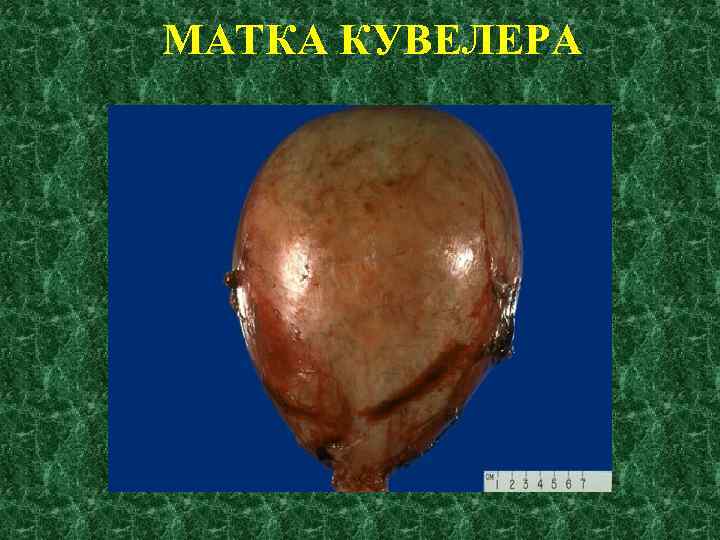 МАТКА КУВЕЛЕРА 