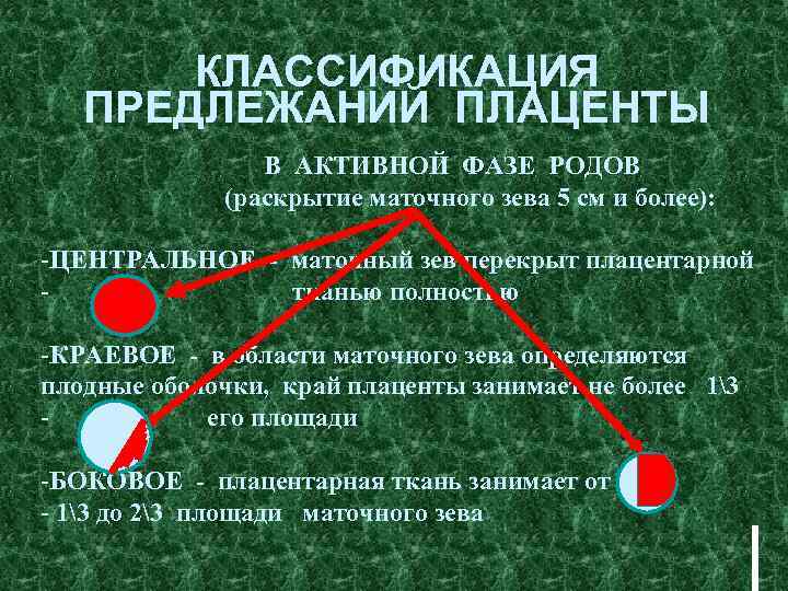 КЛАССИФИКАЦИЯ ПРЕДЛЕЖАНИЙ ПЛАЦЕНТЫ В АКТИВНОЙ ФАЗЕ РОДОВ (раскрытие маточного зева 5 см и более):