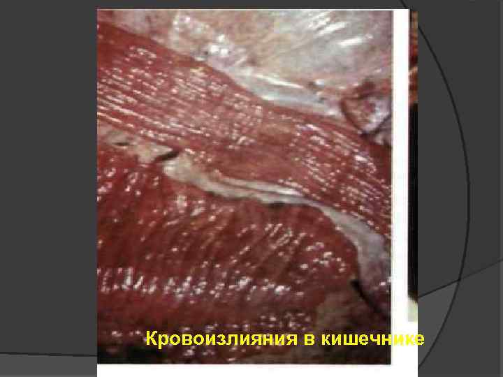 Кровоизлияния в кишечнике 