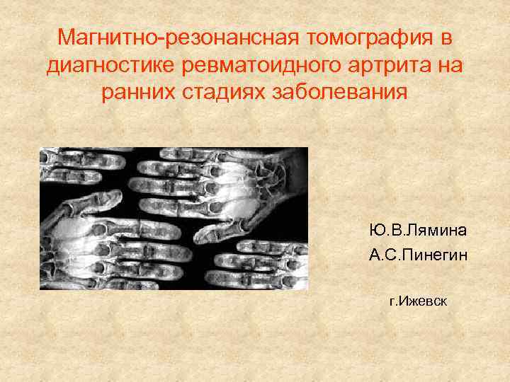 Магнитно-резонансная томография в диагностике ревматоидного артрита на ранних стадиях заболевания Ю. В. Лямина А.