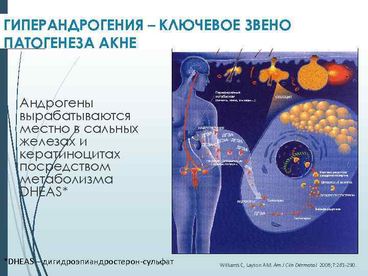 ГИПЕРАНДРОГЕНИЯ – КЛЮЧЕВОЕ ЗВЕНО ПАТОГЕНЕЗА АКНЕ Андрогены вырабатываются местно в сальных железах и кератиноцитах