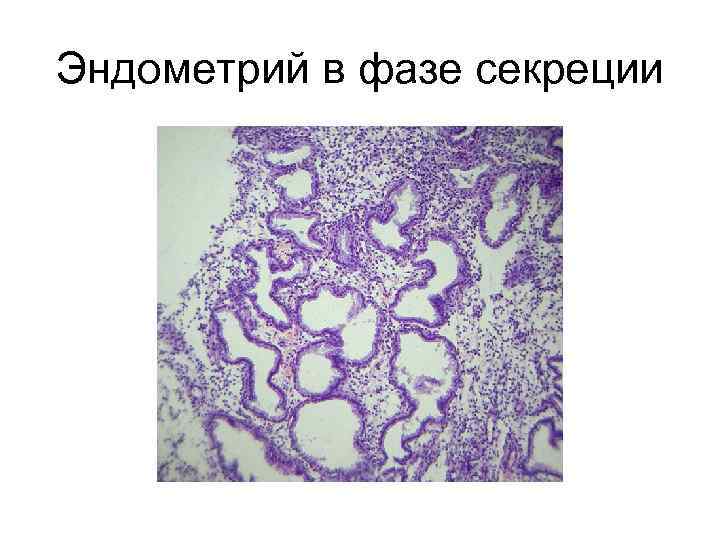 Эндометрий в фазе секреции 