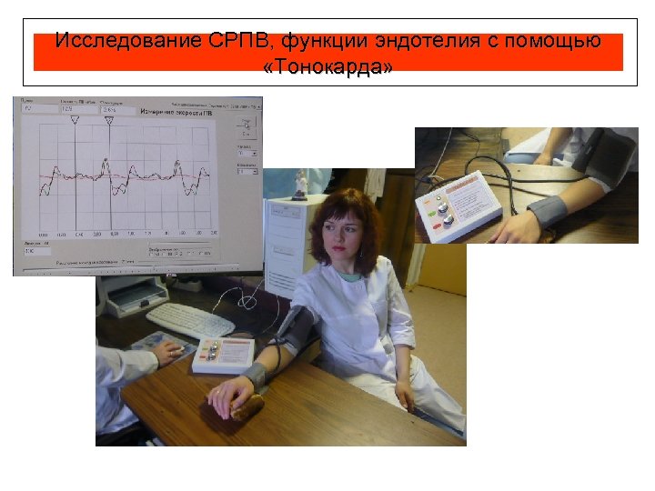 Исследование СРПВ, функции эндотелия с помощью «Тонокарда» 
