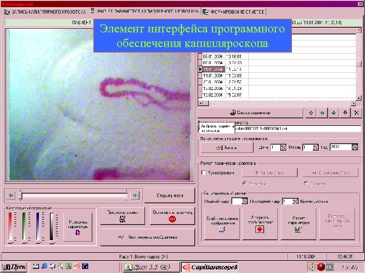 Элемент интерфейса программного обеспечения капилляроскопа 