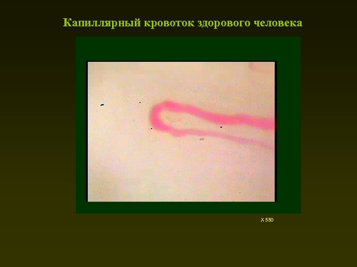 Капиллярный кровоток здорового человека Х 550 