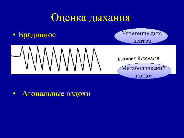 Агональное дыхание