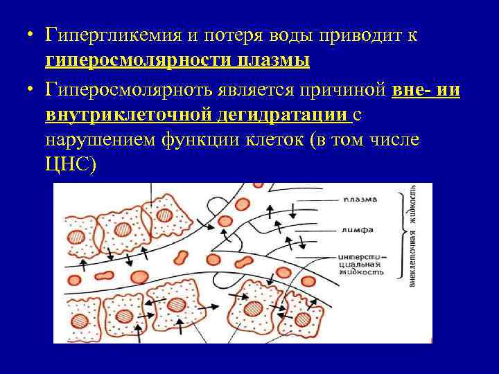  • Гипергликемия и потеря воды приводит к гиперосмолярности плазмы • Гиперосмолярноть является причиной