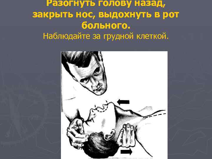 Разогнуть голову назад, закрыть нос, выдохнуть в рот больного. Наблюдайте за грудной клеткой. 