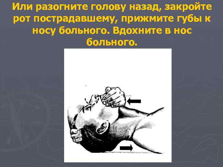 Или разогните голову назад, закройте рот пострадавшему, прижмите губы к носу больного. Вдохните в