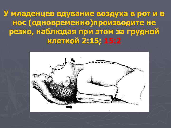 У младенцев вдувание воздуха в рот и в нос (одновременно)производите не резко, наблюдая при