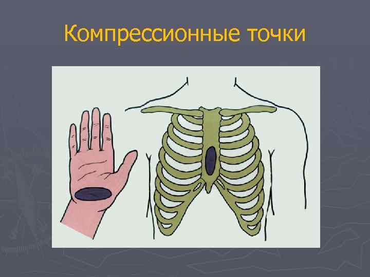 Компрессионные точки 