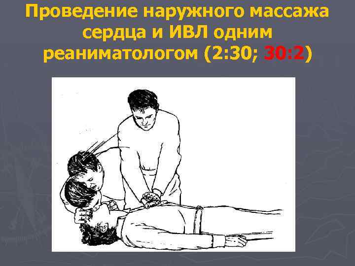 Проведение наружного массажа сердца и ИВЛ одним реаниматологом (2: 30; 30: 2) 