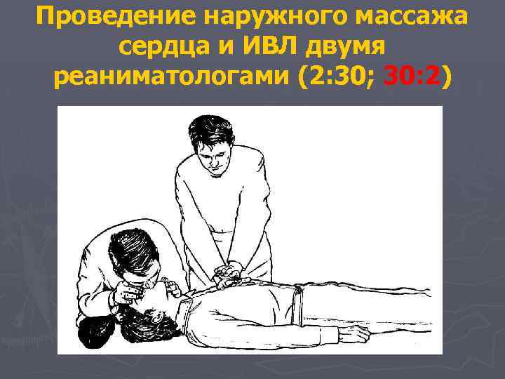 Проведение наружного массажа сердца и ИВЛ двумя реаниматологами (2: 30; 30: 2) 