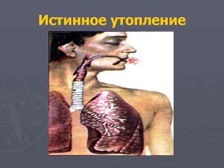 Истинное утопление 