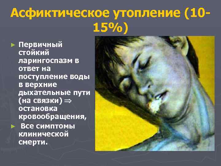 Асфиктическое утопление (1015%) Первичный стойкий ларингоспазм в ответ на поступление воды в верхние дыхательные