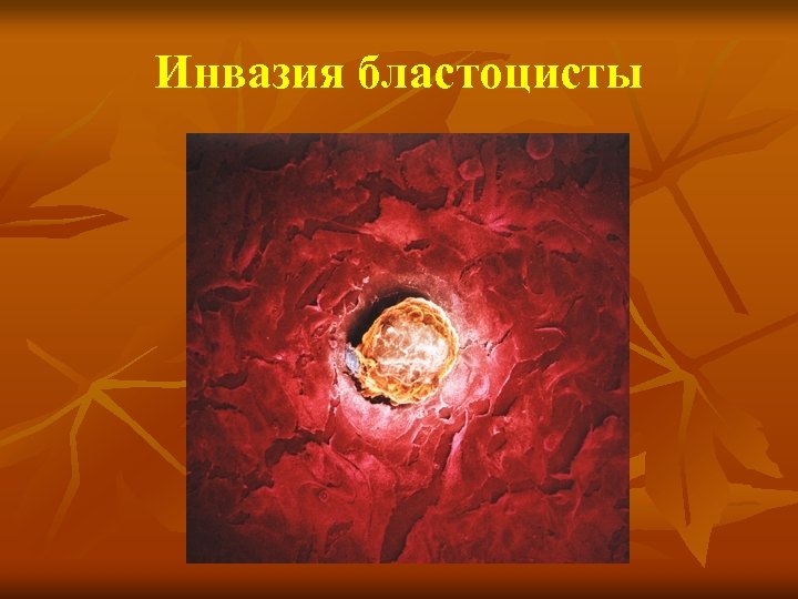 Инвазия бластоцисты 