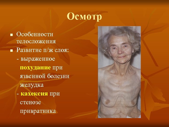 Осмотр n n Особенности телосложения Развитие п/ж слоя: выраженное похудание при язвенной болезни желудка