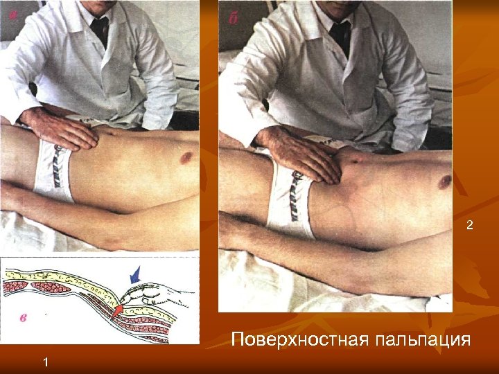 2 Поверхностная пальпация 1 