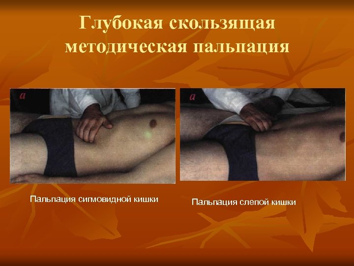 Глубокая скользящая методическая пальпация Пальпация сигмовидной кишки Пальпация слепой кишки 
