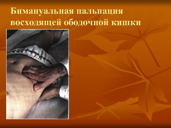 Бимануальная пальпация восходящей ободочной кишки 