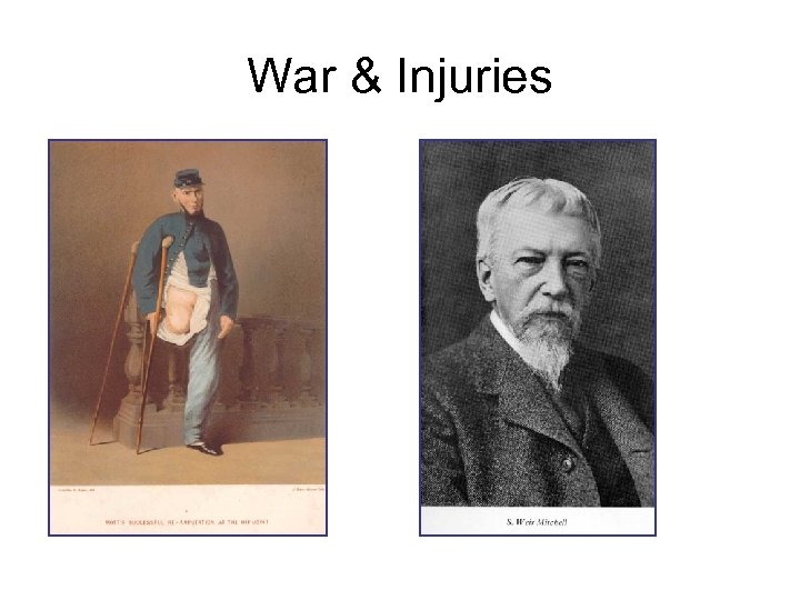 War & Injuries 