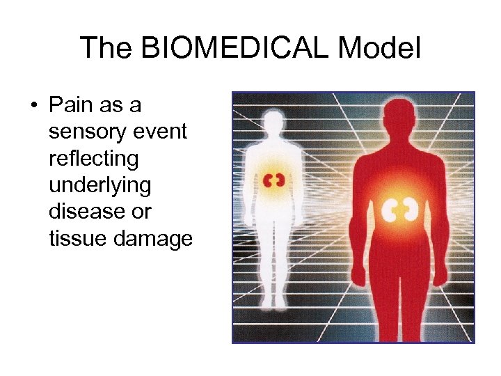The BIOMEDICAL Model • Pain as a sensory event reflecting underlying disease or tissue