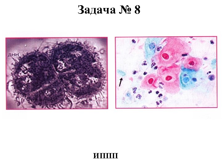 Задача № 8 ИППП 