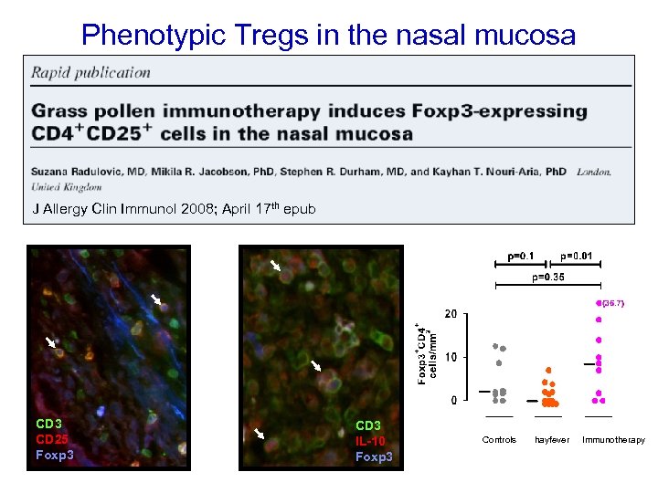 Phenotypic Tregs in the nasal mucosa J Allergy Clin Immunol 2008; April 17 th